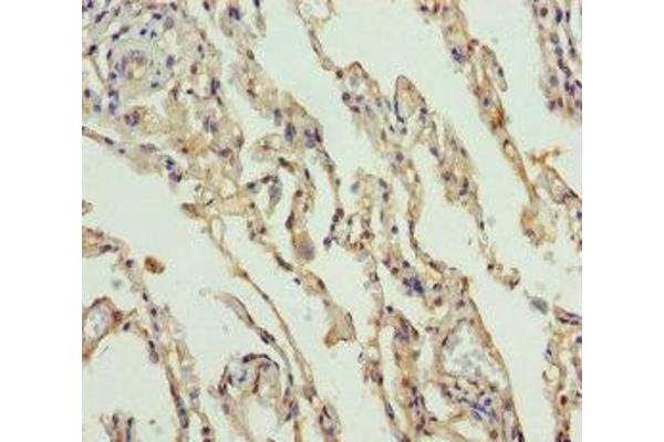 Solute Carrier Family 34 (Type II Sodium/phosphate Contransporter), Member 1 (SLC34A1) (AA 1-103) antibody