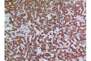 Immunohistochemical analysis of paraffin-embedded human-liver, antibody was diluted at 1:100. (APAF1 antibody  (Internal Region))