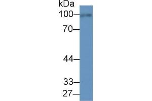 Western Blotting (WB) image for Fibulin 1 (FBLN1) ELISA Kit (ABIN6720586)