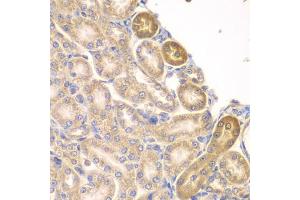 Immunohistochemistry of paraffin-embedded rat kidney using PIP4K2A antibody (ABIN5975539) at dilution of 1/100 (40x lens). (PIP4K2A antibody)