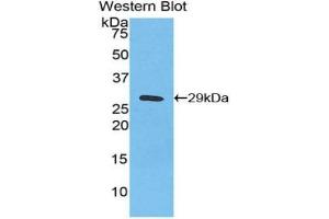 Detection of Recombinant IkBz, Human using Polyclonal Antibody to Inhibitory Subunit Of NF Kappa B Zeta (IkBz) (Inhibitory Subunit of NF-KappaB zeta (AA 422-651) antibody)