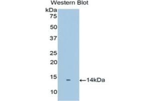 Detection of Recombinant PSCA, Human using Polyclonal Antibody to Prostate Stem Cell Antigen (PSCA) (PSCA antibody  (AA 22-123))