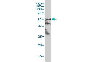 RARA monoclonal antibody (M02), clone 1C10 Western Blot analysis of RARA expression in Hela S3 NE . (Retinoic Acid Receptor alpha antibody  (AA 315-424))