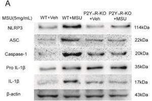 NLRP3 inflammasome activation was involved in P2Y14R deficiency. (beta Actin antibody  (AA 1-50))