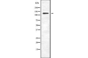 Phospholipase C beta 4 antibody  (Internal Region)