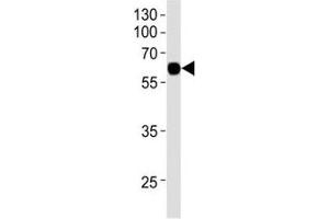 Western blot analysis of recombinant protein using KLF4 antibody at 1:1000. (KLF4 antibody)