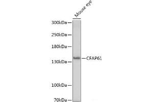 Western blot analysis of extracts of Mouse eye using CFAP61 Polyclonal Antibody at dilution of 1:1000. (CFAP61 antibody)