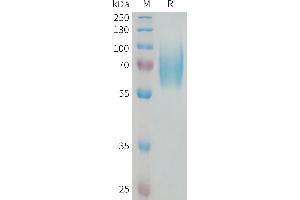 Human N Protein, His Tag on SDS-PAGE under reducing condition. (TRKB Protein (AA 32-430) (His tag))