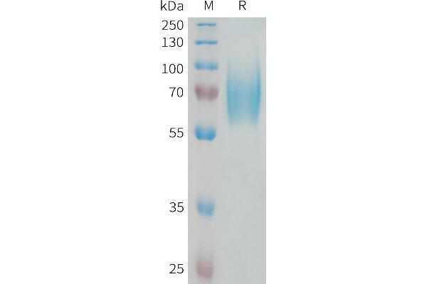 TRKB Protein (AA 32-430) (His tag)