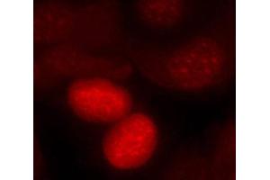Immunofluorescence staining of methanol-fixed MCF7 cells, using phospho-FOXO1-S256 antibody. (FOXO1 antibody  (pSer256))