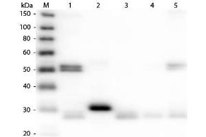 Western Blotting (WB) image for Donkey anti-Rat IgG (Heavy & Light Chain) antibody (Alkaline Phosphatase (AP)) - Preadsorbed (ABIN102102)