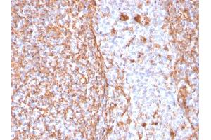 Immunohistochemistry (IHC) image for anti-Vimentin (VIM) antibody (ABIN6940885)