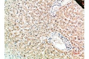 Immunohistochemical analysis of paraffin-embedded human-liver, antibody was diluted at 1:200. (TNFRSF11A antibody  (AA 60-120))