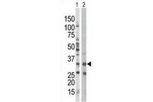 Western Blotting (WB) image for anti-Protein Kinase, AMP-Activated, beta 1 Non-Catalytic Subunit (PRKAB1) antibody (ABIN3002958) (PRKAB1 antibody)