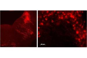 Immunohistochemistry (0. (Tryptophan Hydroxylase 2 antibody  (Internal Region))