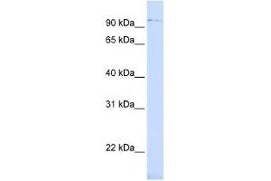 ZNF598 antibody used at 0. (ZNF598 antibody  (Middle Region))