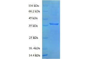 SDS-PAGE (SDS) image for MDH (AA 1-312), (full length) protein (His tag) (ABIN5713158) (MDH (AA 1-312), (full length) protein (His tag))