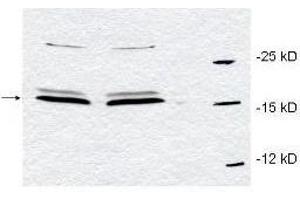 Western blot using  affinity purified anti-Pin1 antibody to detect endogenous Pin1 in HeLa whole cell lysates. (PIN1 antibody  (Internal Region))