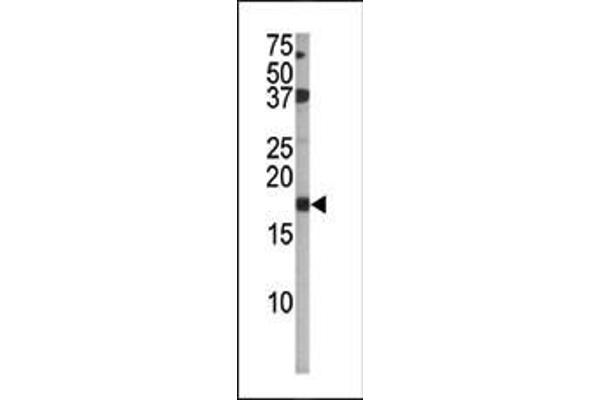 CDKN2A antibody  (pSer140)