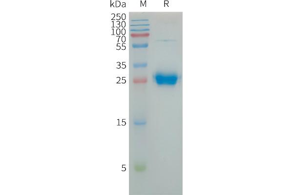 Coxsackie Adenovirus Receptor Protein (AA 20-237) (His tag)