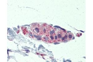 TNKS antibody was used for immunohistochemistry at a concentration of 4-8 ug/ml. (TNKS antibody  (Middle Region))