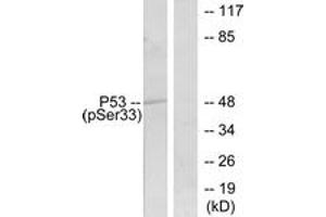 Western blot analysis of extracts from 293 cells treated with UV, using p53 (Phospho-Ser33) Antibody. (p53 antibody  (pSer33))