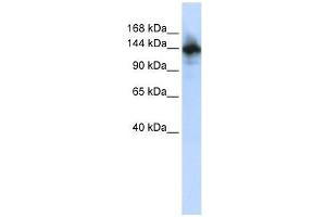 RBM6 antibody used at 2. (RBM6 antibody  (N-Term))