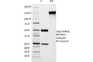 SDS-PAGE Analysis Purified pS2 Mouse Monoclonal Antibody (SPM313). (TFF1 antibody  (AA 57-84))