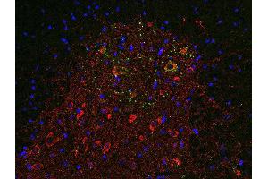 Immunohistochemistry (Paraffin-embedded Sections) (IHC (p)) image for anti-Solute Carrier Family 18 (Vesicular Acetylcholine), Member 3 (SLC18A3) (AA 475-530), (C-Term) antibody (ABIN1742304)