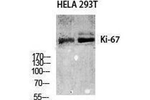 Western Blotting (WB) image for anti-Antigen Identified By Monoclonal Antibody Ki-67 (MKI67) (C-Term) antibody (ABIN3185293) (Ki-67 antibody  (C-Term))