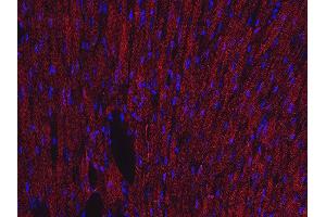 Immunohistochemistry (Paraffin-embedded Sections) (IHC (p)) image for anti-Actin, beta (ACTB) (AA 2-16) antibody (ABIN1742508)