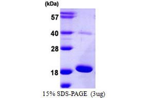 POMC Protein (AA 27-267) (His tag)