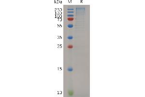 Mouse L Protein, His Tag on SDS-PAGE under reducing condition. (LAMa4 Protein (AA 25-1816) (His tag))