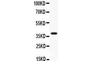 Anti- GAD67 Picoband antibody, Western blotting All lanes: Anti GAD67  at 0. (GAD antibody  (AA 14-122))