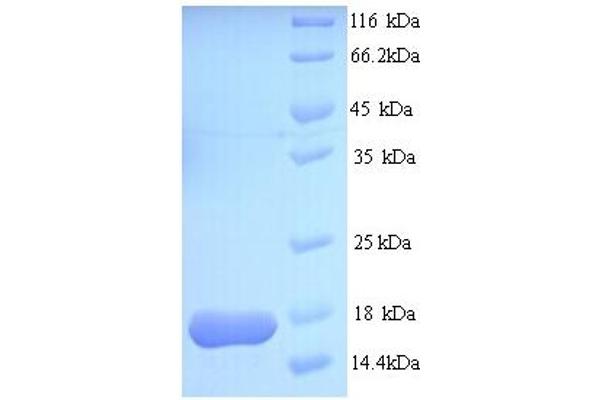 ATP-Binding Cassette, Sub-Family B (MDR/TAP), Member 1B (ABCB1B) (AA 1-114), (full length) protein (His tag)