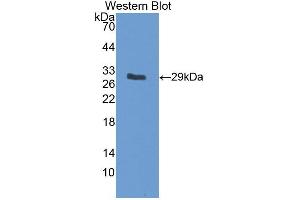 Figure. (SLC12A7 antibody  (AA 845-1056))