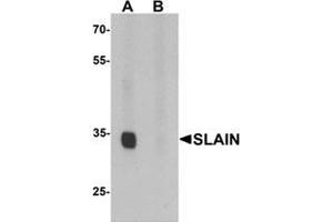 Western blot analysis of SLAIN1 in A549 cell lysate with SLAIN1 antibody at 1 ug/mL in (A) the absence and (B) the presence of blocking peptide. (SLAIN1 antibody  (C-Term))