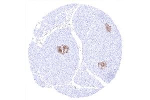 Positive NSE immunostaining of islets of Langerhans (ENO2/NSE antibody  (AA 416-433))