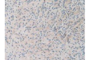 IHC-P analysis of Human Prostate Gland Tissue, with DAB staining. (SQSTM1 antibody  (AA 136-400))