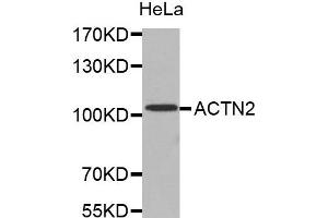 Western Blotting (WB) image for anti-Actinin, alpha 2 (ACTN2) antibody (ABIN1870791) (ACTN2 antibody)