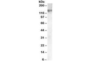 Western blot testing of A549 lysate with ABCC1 antibody at 0. (ABCC1 antibody)