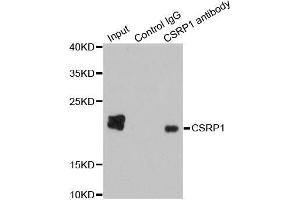 Immunoprecipitation analysis of 200 μg extracts of HepG2 cells using 1 μg CSRP1 antibody (ABIN5970430). (CSRP1 antibody)