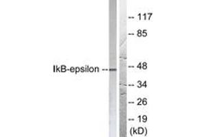 Western blot analysis of extracts from HeLa cells, treated with TNF-a 20ng/ml 5', using IkappaB-epsilon (Ab-22) Antibody. (IkappaB-epsilon antibody  (AA 131-180))