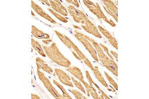 Immunohistochemistry (Paraffin-embedded Sections) (IHC (p)) image for anti-Very Low Density Lipoprotein Receptor (VLDLR) (AA 484-510) antibody (ABIN651940)