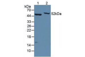 Figure. (ENO2/NSE antibody  (AA 2-285))