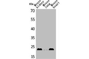 Western Blot analysis of mouse kidney mouse lung mouse heart cells using ADM Polyclonal Antibody (Adrenomedullin antibody  (Internal Region))