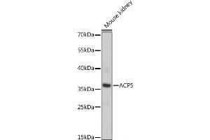 Western blot analysis of extracts of Mouse kidney using ACP5 Polyclonal Antibody at dilution of 1:1000. (ACP5 antibody)