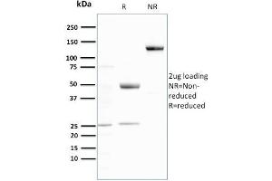 SDS-PAGE Analysis Purified Ubiquitin Recombinant Rabbit Monoclonal Antibody (UBB/3143R). (Recombinant Ubiquitin B antibody  (AA 1-119))