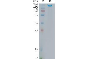 Human I Protein, hFc Tag on SDS-PAGE under reducing condition. (ITGB6 Protein (AA 22-707) (Fc Tag))