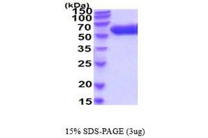 SDS-PAGE (SDS) image for Arylsulfatase A (ARSA) (AA 18-506) protein (His tag) (ABIN5854724) (Arylsulfatase A Protein (ARSA) (AA 18-506) (His tag))